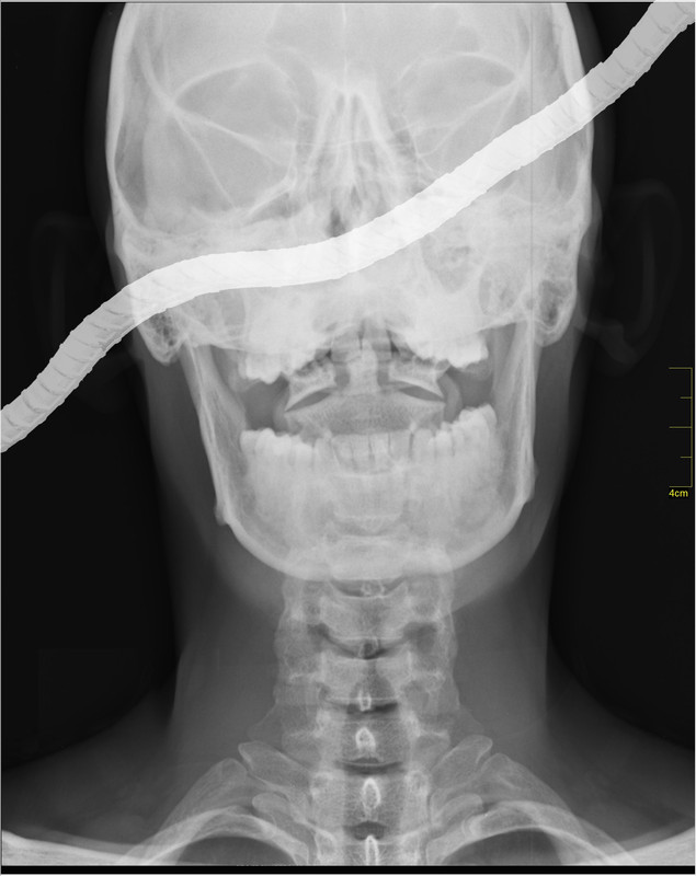 Rebar-x-ray.jpg