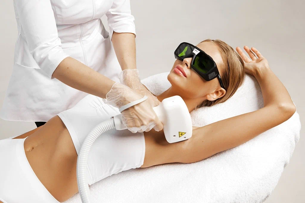 Лазерная эпиляция