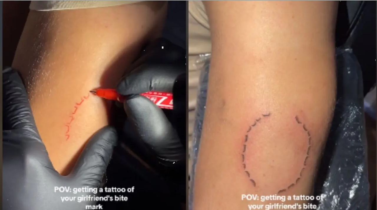 Hombre se tatúa mordida que su novia le dejó y se hace viral