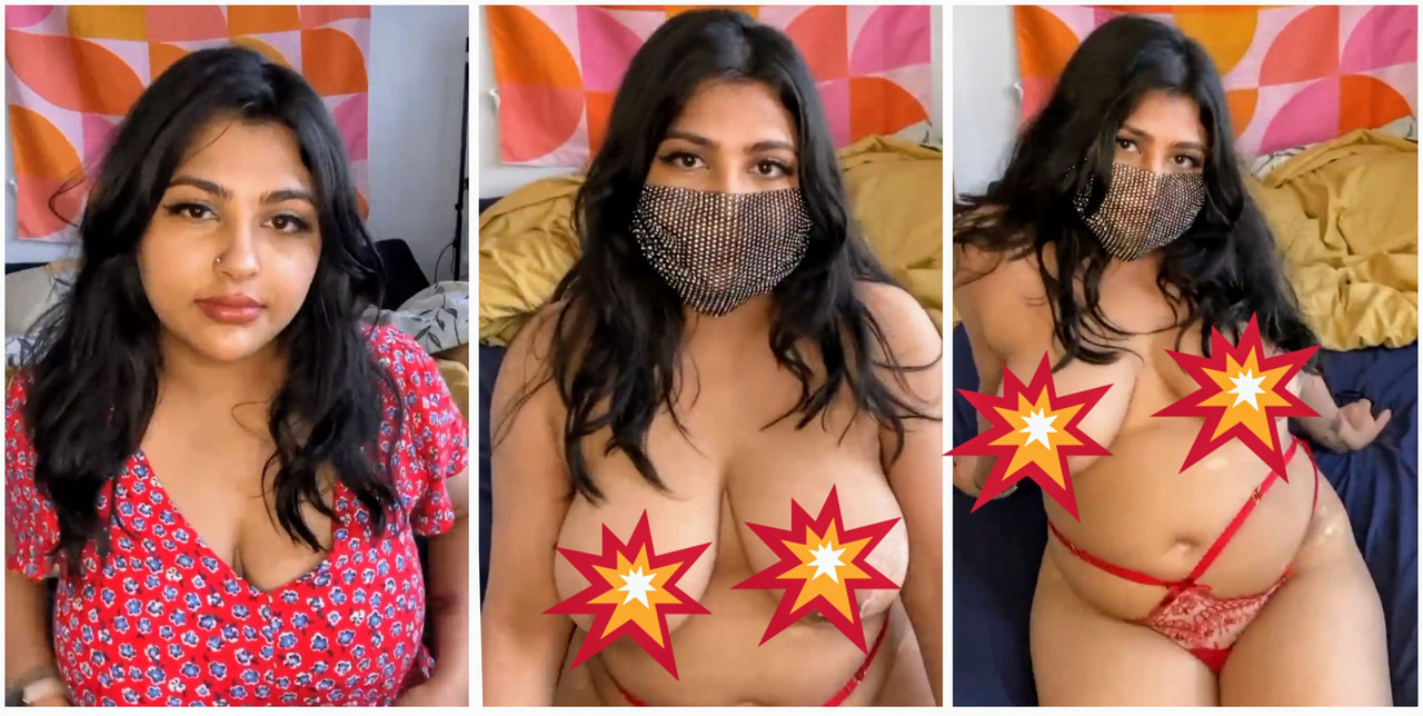 Famous Desi Beautiful Girl OF VITILGO-KITTEN Exclusive