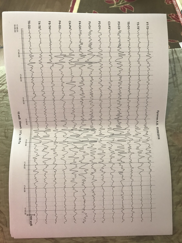 E9539F9F-D15C-48A1-9C01-5828ADB1ACC9