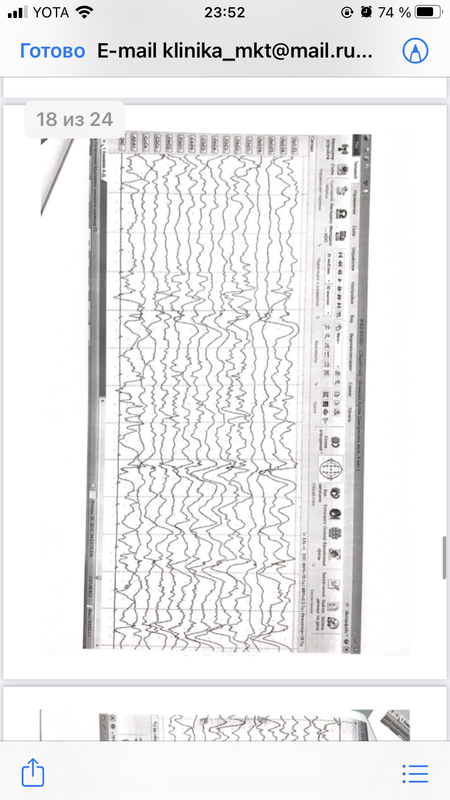 78D81C17-9431-4889-897F-2FE81CA649A6