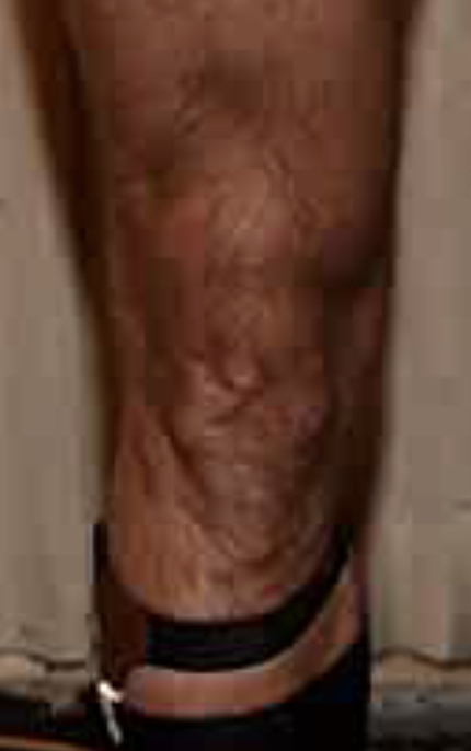 71608-CF2-D7-F1-4-C9-F-B821-FFBB959-D037