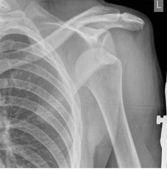 Orthopedics question 6 image