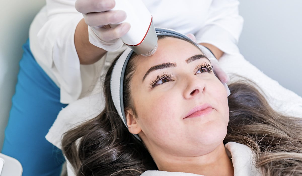 How many microneedling sessions for acne scars