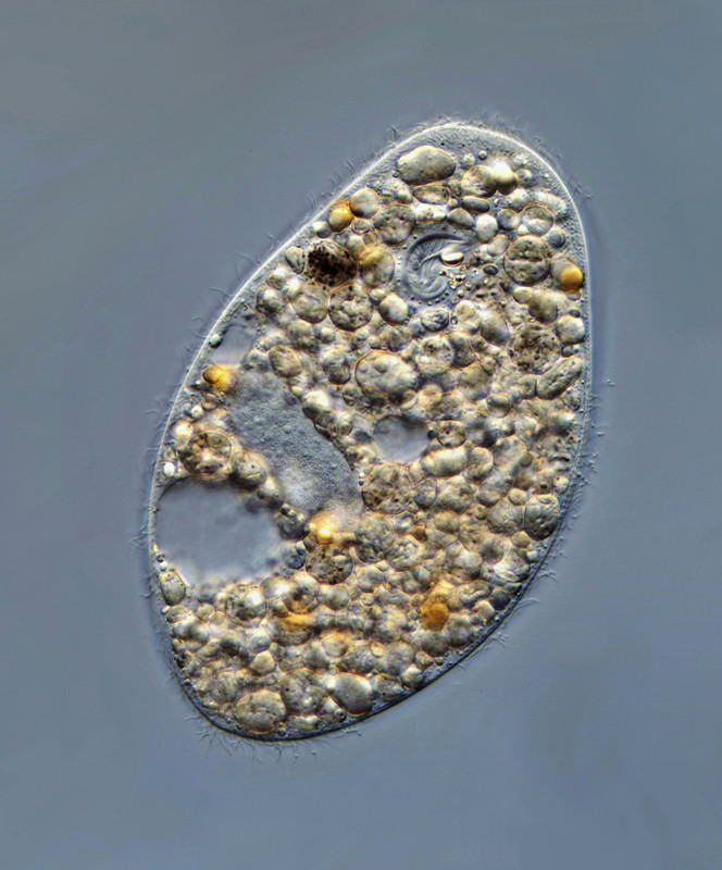 Ophryoglena 03 (ev) atra Osterei-Ciliat zwei Kontraktile Vakuolen Trichocysten (Mucocysten) re oben 