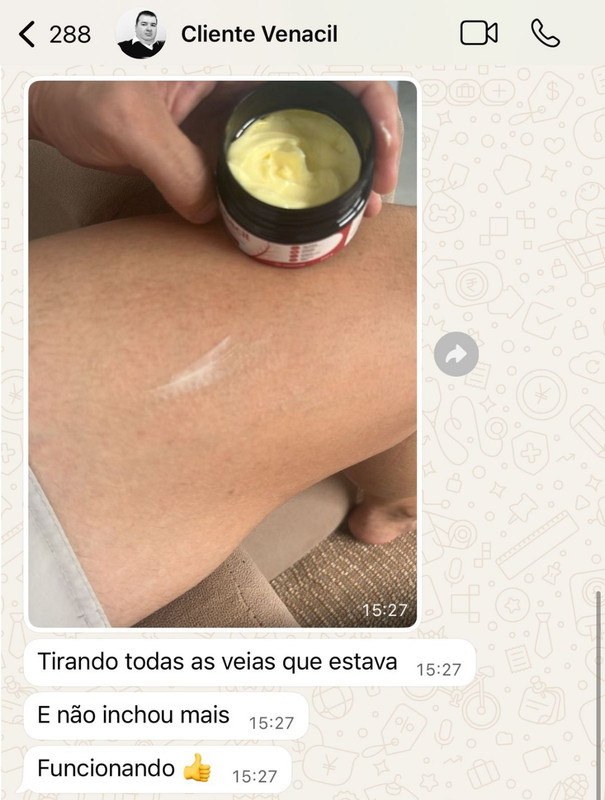 Print WhatsApp cliente creme para varizes