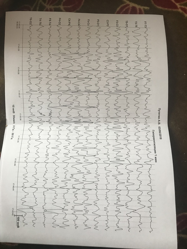 0462DC2A-C756-4CC3-8673-3A188987953F