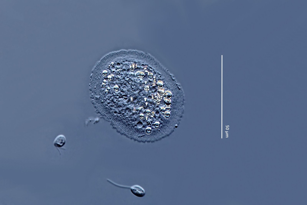 Cochliopodium 01 bilimbosum Schnecken-Amöbe Plastische Schalen-Amöbe (Kreutz 99) DIK 50 Stack 2-Z7