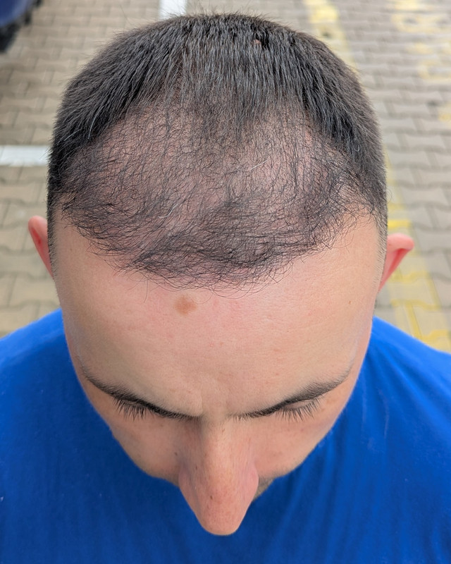 PXL_20250626_104053934.MP~2