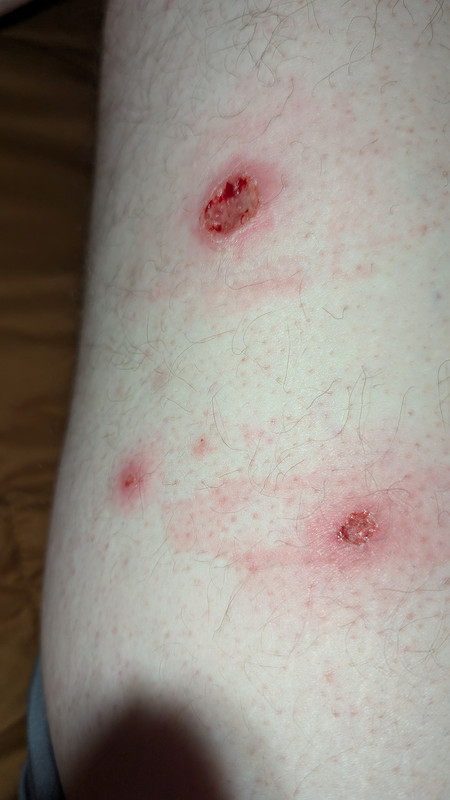 PXL 20251206 045643246