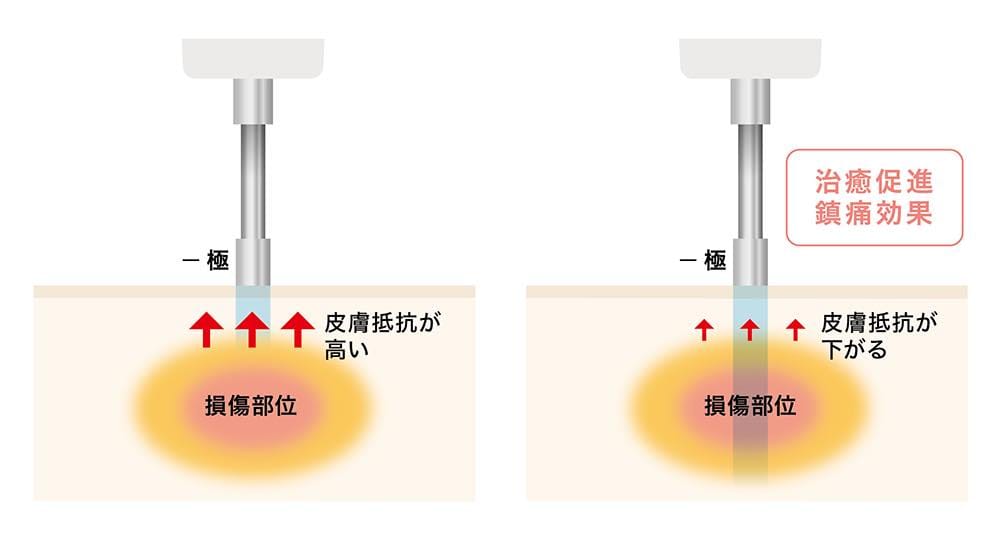 インピーダンス測定画面1