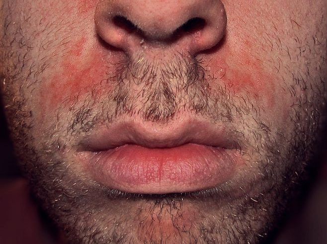 Barba