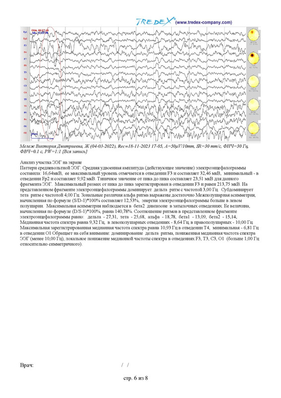 5D6A87C4-F84D-4F87-8F2B-AD9DF19D2F15