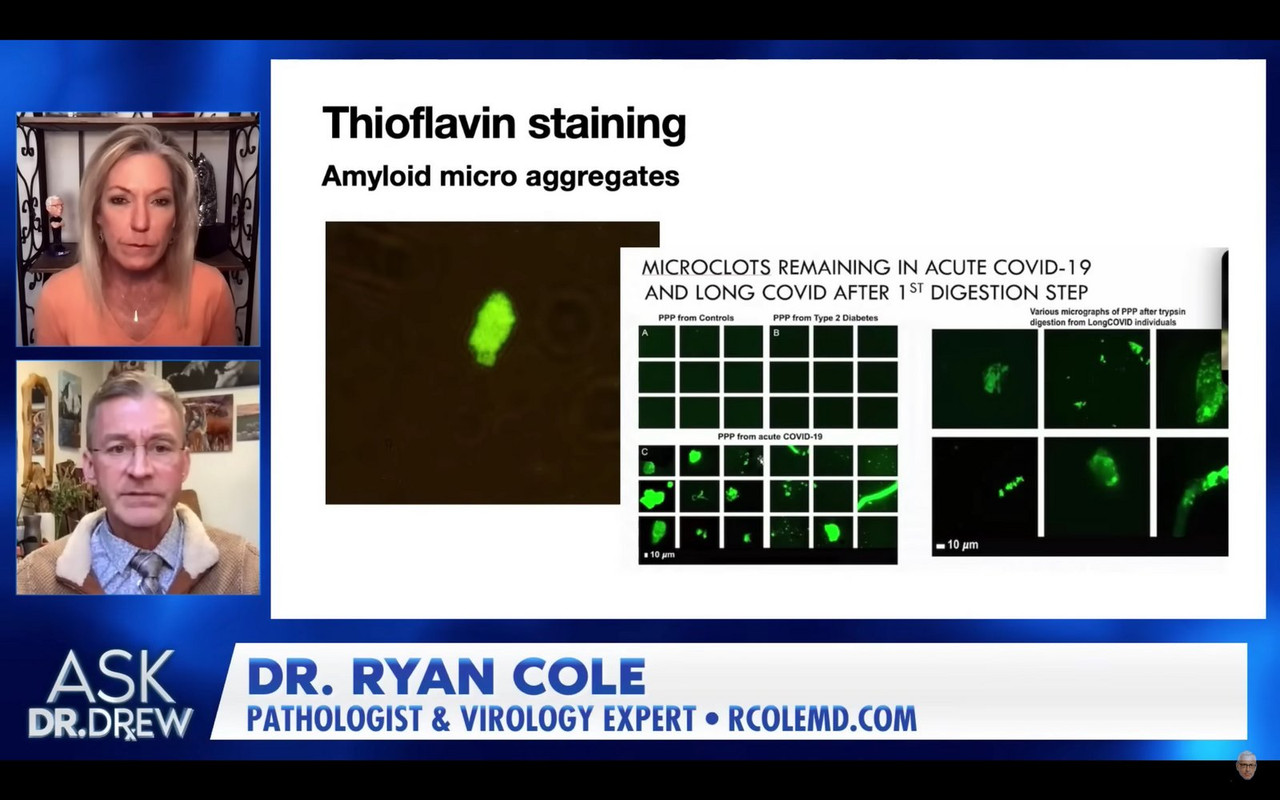 microclots.detection