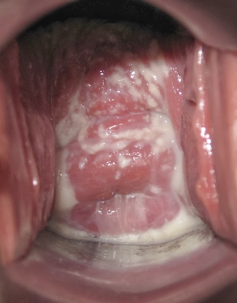 Gynecology question 4 image