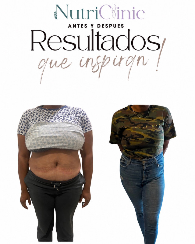 Resultado antes y después 3