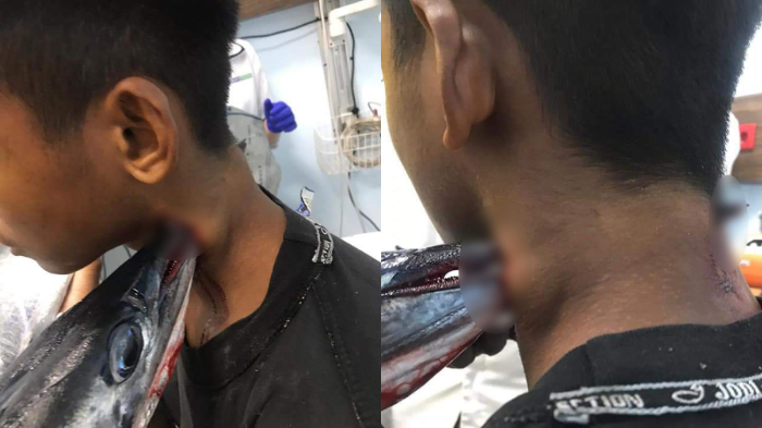 Remaja diserang ikan sori atau ikan marlin