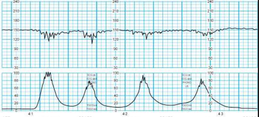 Obstetrics question 6 image