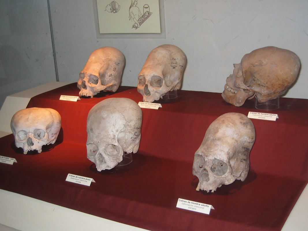 015 20050305 1138 Craneos deformados