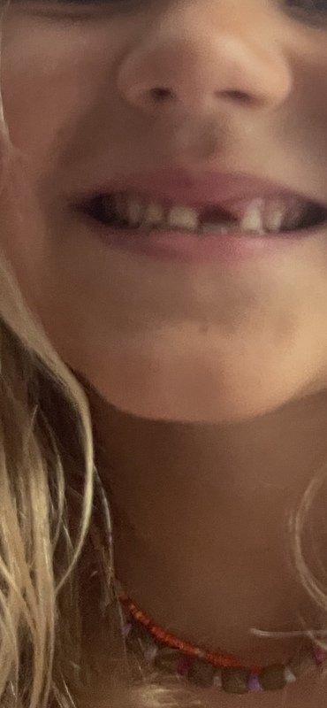 560EAB3B-1BDD-4CFF-BB44-26E11793E30B