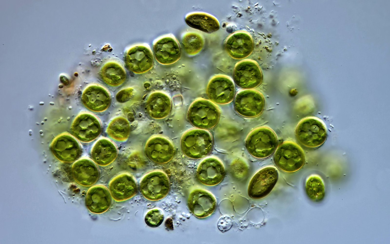 Microspora 19 (ev) floccosa oder wittrockii Doppelbecher-Alge Zerfallende Zellen DIK 100