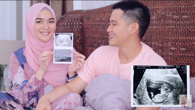 Citra Kirana memegang hasil USG dari calon buah hatinya