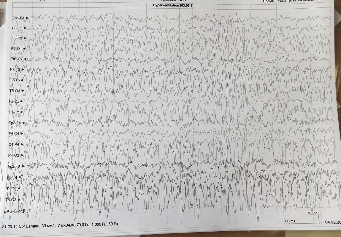 1368A1C0-63B3-4EE7-B61D-CA1C3F3B0847