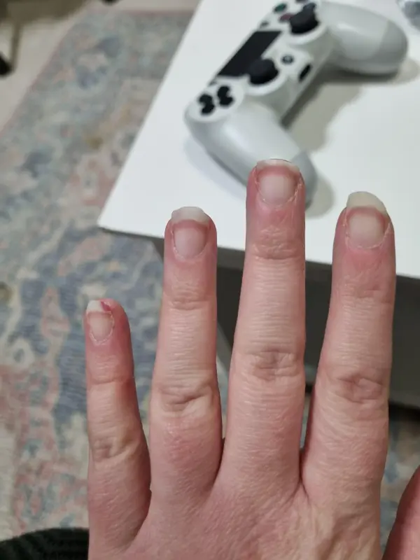 6-years-searching-for-diagnosis-just-found-multiple-v0-c888zlksxyod1