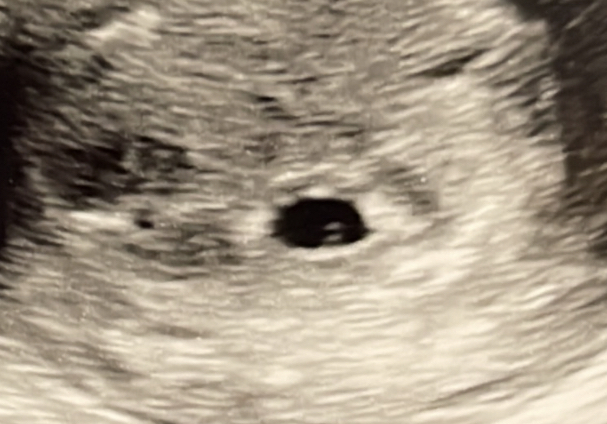 C59157F8-53D3-4794-AEC7-D2A60BA537A4