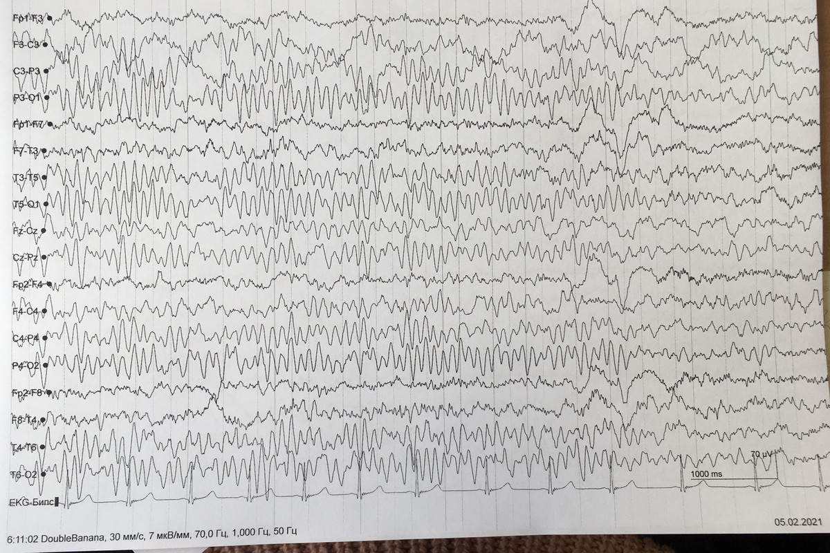 AD36DF0B-D4E9-4A73-B0E9-C462D4BFF154