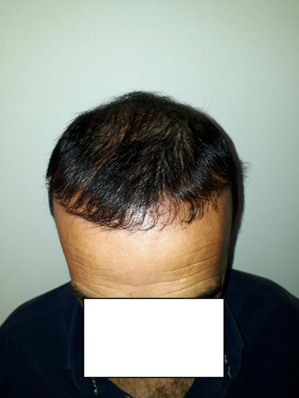 WhatsApp Image 2017-10-21 at 16.31.24