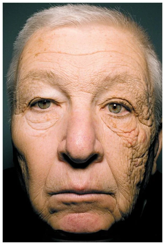 truck-drivers-Face