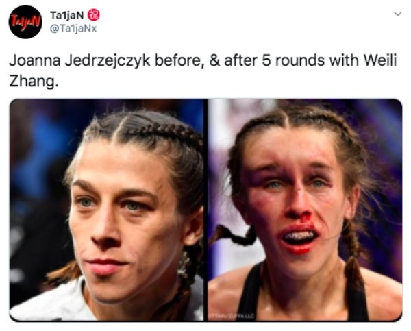 Before-After-6