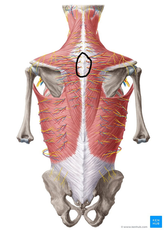 Area of Pain