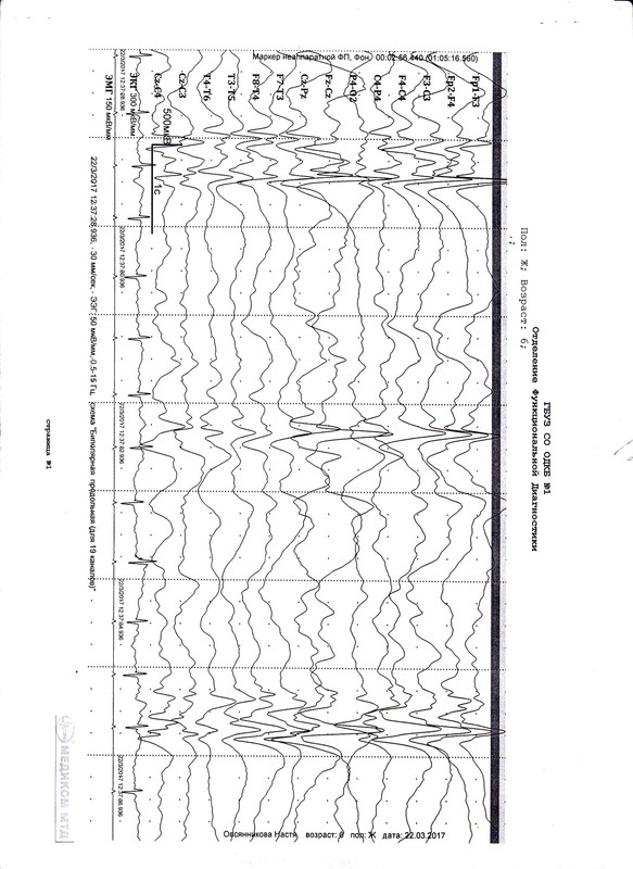 ЭЭг лис7от 03.17