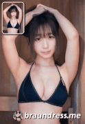 310-ANALGAPPING-GIF-SAMPLE