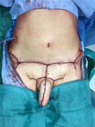 tranny penis 11 frankenstein