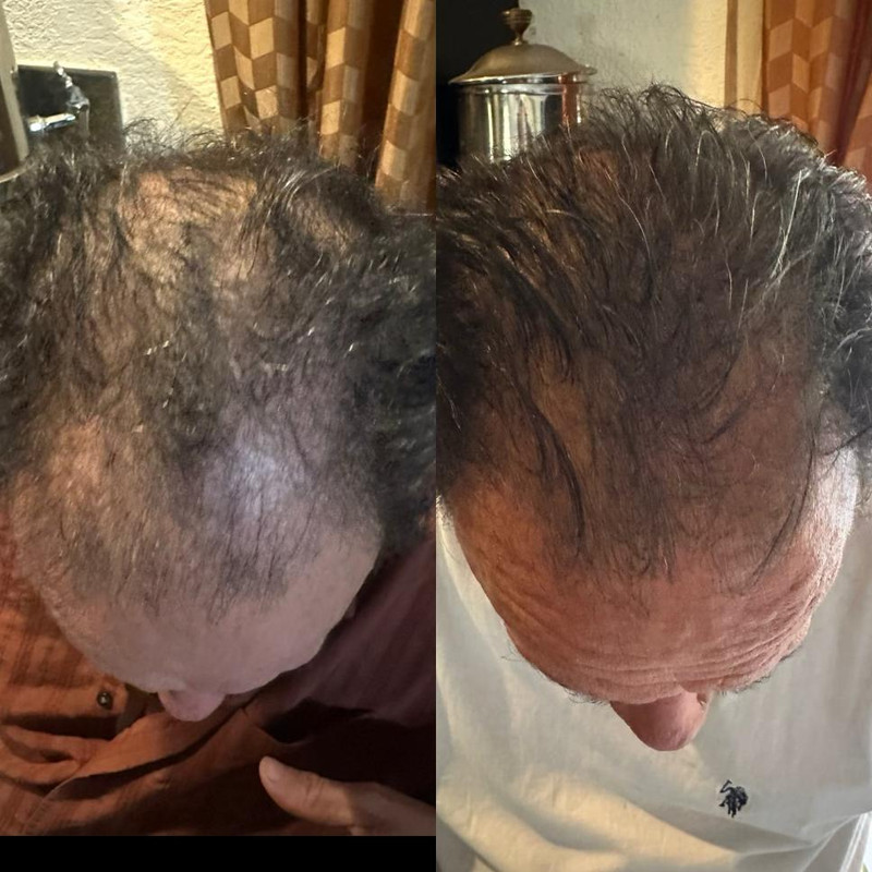 Before treatment