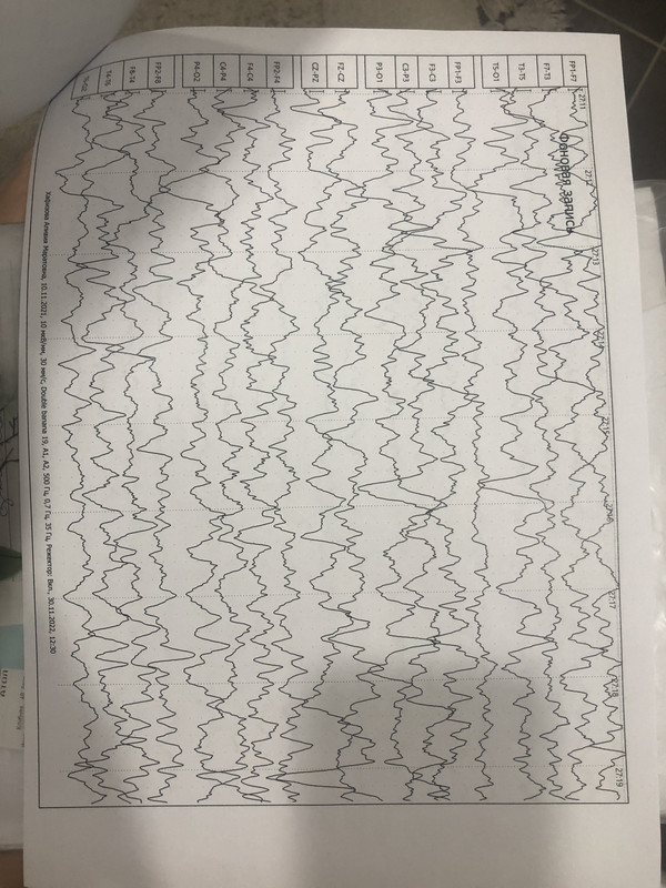 47ED8E85-FC78-4FF1-AA7A-936ED4261387