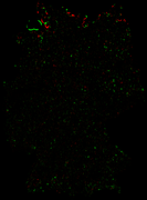 202607-diff-dt-4g