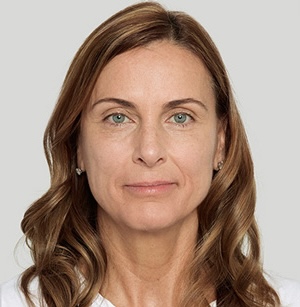 After Sculptra treatment at Let's Face It Med Spa