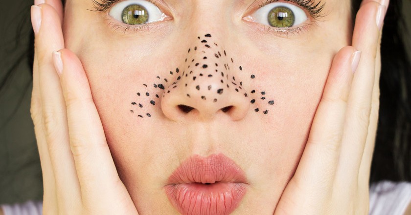 Quick Guide to Help You Understand Oily Skin and Sebaceous Filaments