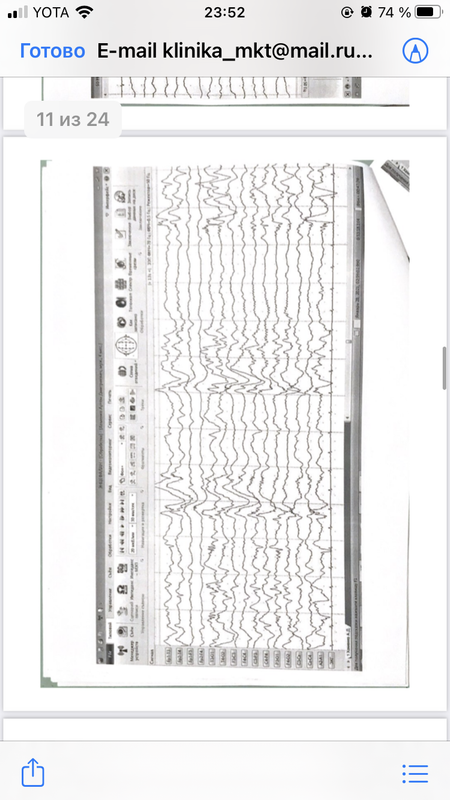 A2DA72B4-400E-49F7-884B-54C338F6D7A5