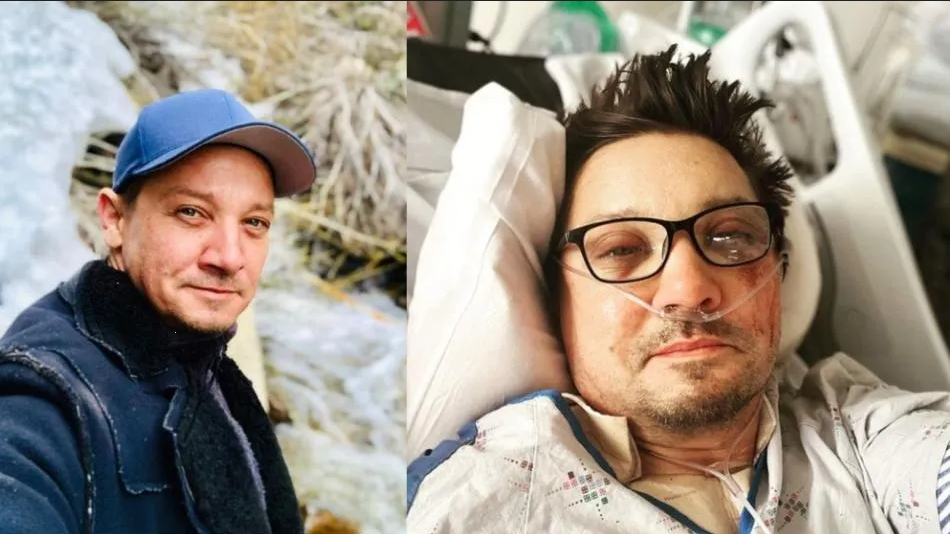 Actor de Marvel muestra como luce su cuerpo, tras ser arrollado por una máquina