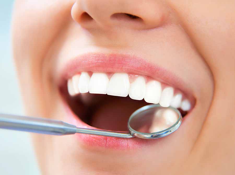 Dental Checkup