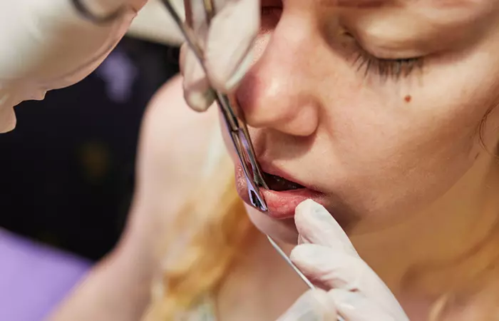 Different types of lip piercings