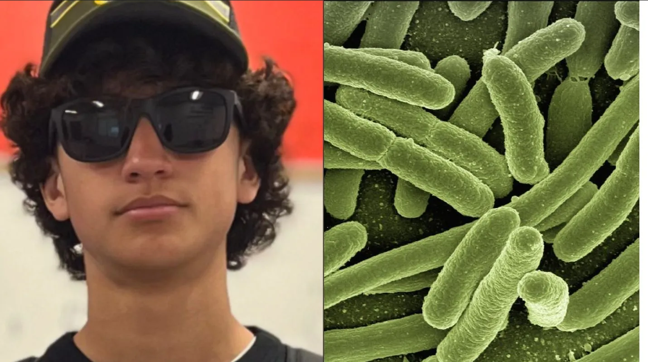 Bacteria obliga a niño a que le amputen brazos y piernas en Miami