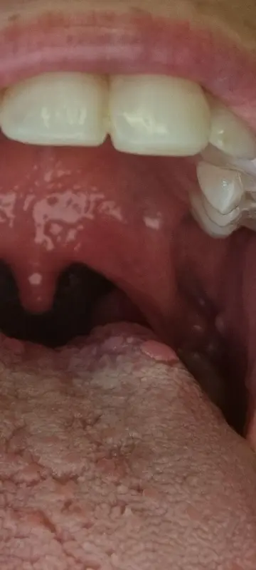 6-years-searching-for-diagnosis-just-found-multiple-v0-804p6b99wyod1