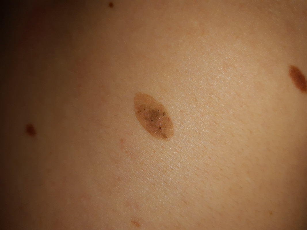 IMG_20220529_224403093